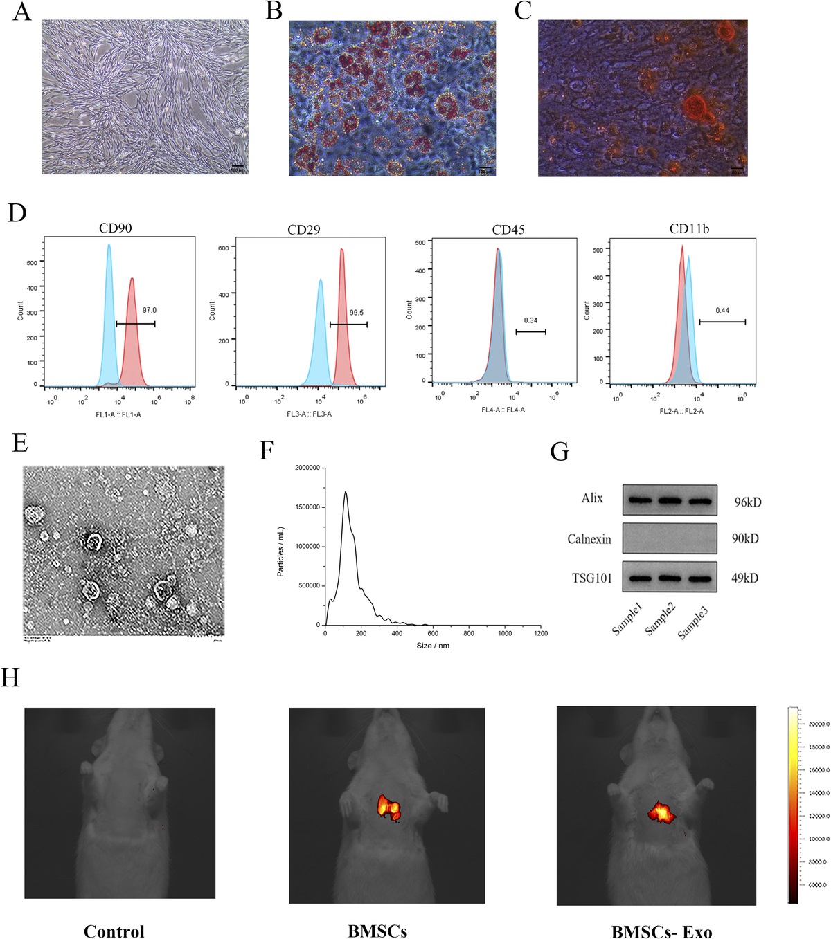 EFFECT OF EXOSOMES DERIVED FROM BONE MARROW MESENCHYMAL STEM CELLS ON PROGRAMMED CELL DEATH IN BLAST-INDUCED LUNG INJURY IN RATS