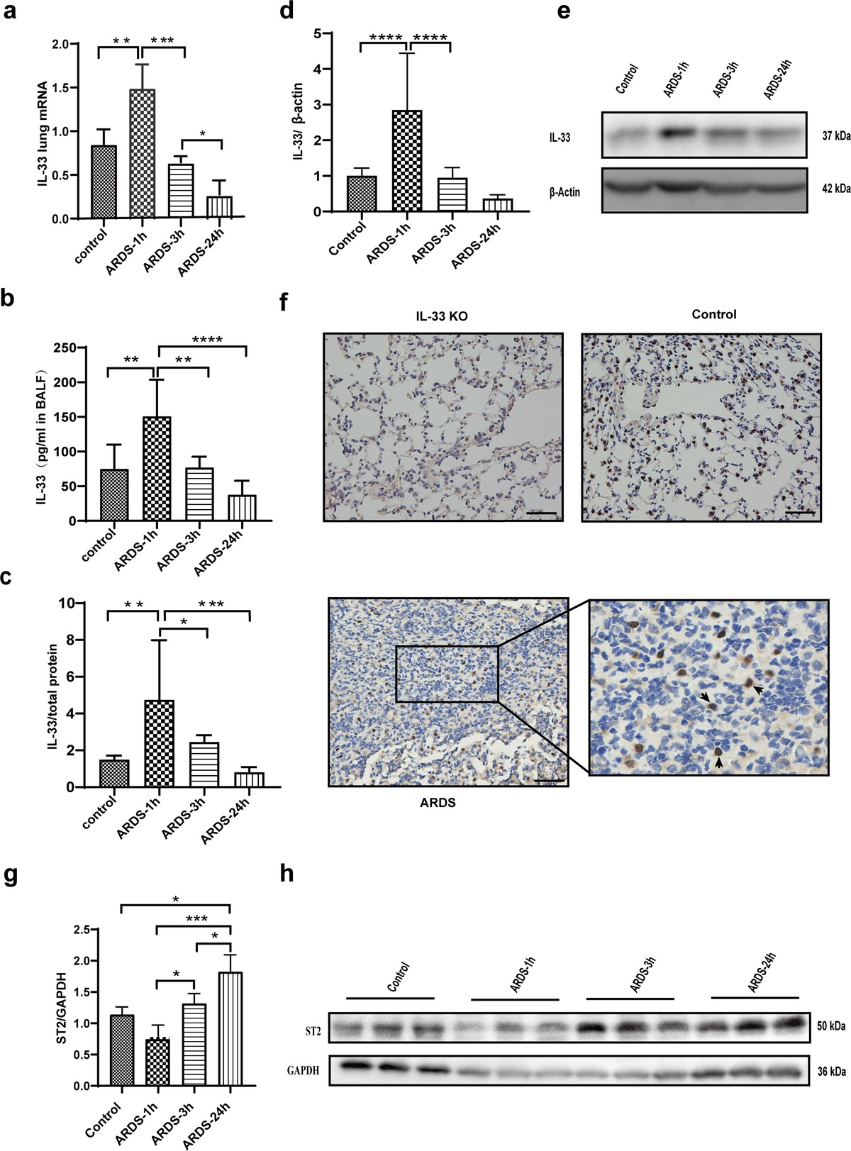 THE IL-33/ST2 AXIS PROMOTES ACUTE RESPIRATORY DISTRESS SYNDROME BY NATURAL KILLER T CELLS