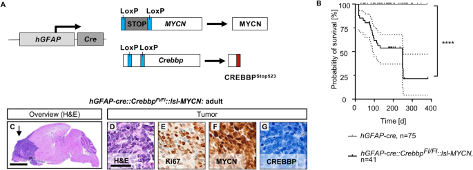 The tumor suppressor CREBBP and the oncogene MYCN cooperate to induce malignant brain tumors in mice