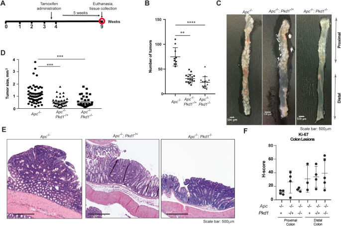 Loss of Pkd1 limits susceptibility to colitis and colorectal cancer