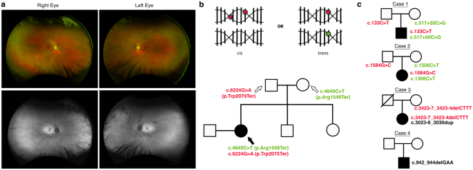Familial co-segregation and the emerging role of long-read sequencing to re-classify variants of uncertain significance in inherited retinal diseases