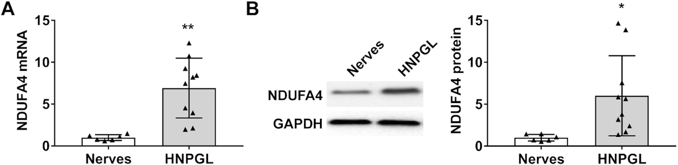 NDUFA4 promotes the progression of head and neck paraganglioma by inhibiting ferroptosis