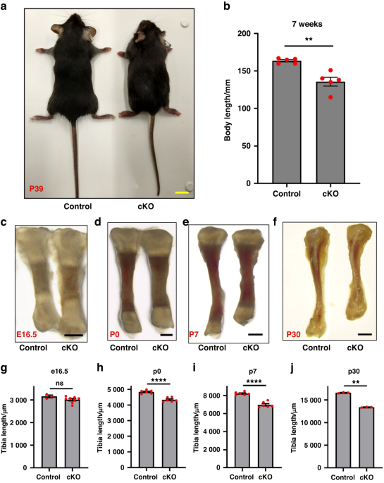 α-parvin controls chondrocyte column formation and regulates long bone development