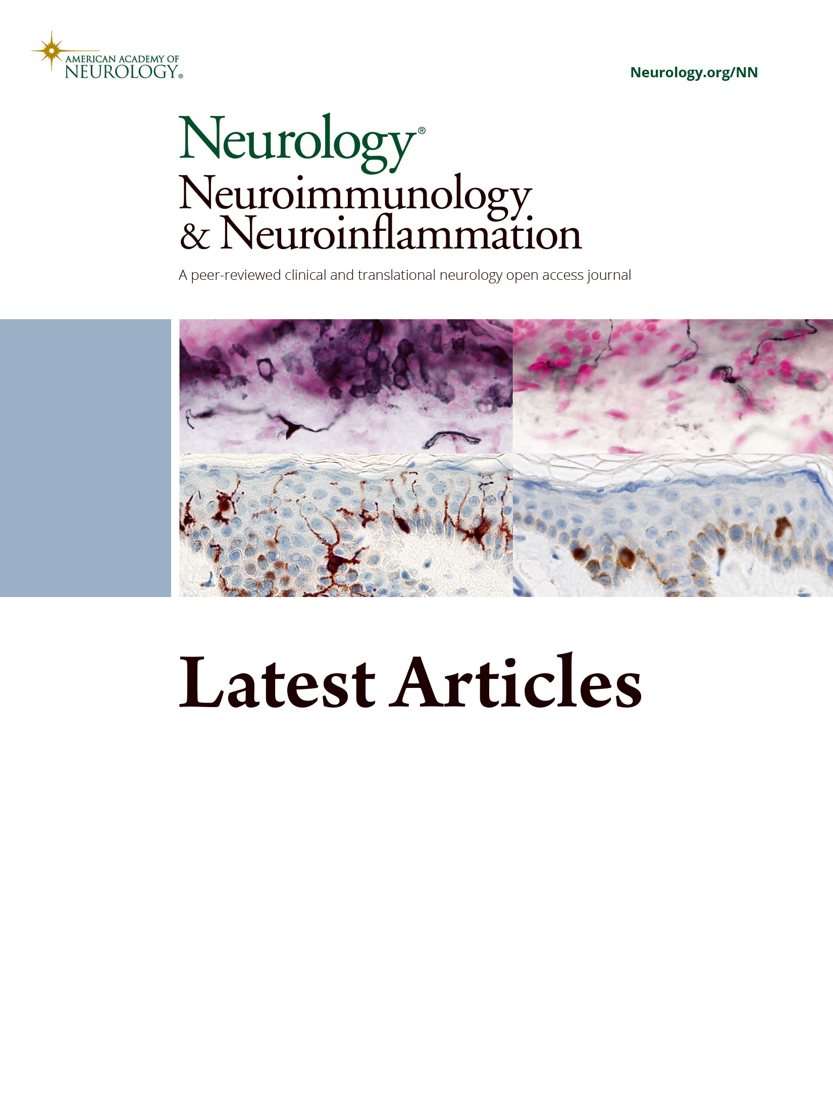 Trigeminal Nerve Involvement in Bulbar-Onset Anti-IgLON5 Disease