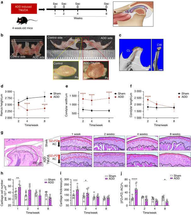 Divergent chondro/osteogenic transduction laws of fibrocartilage stem cell drive temporomandibular joint osteoarthritis in growing mice