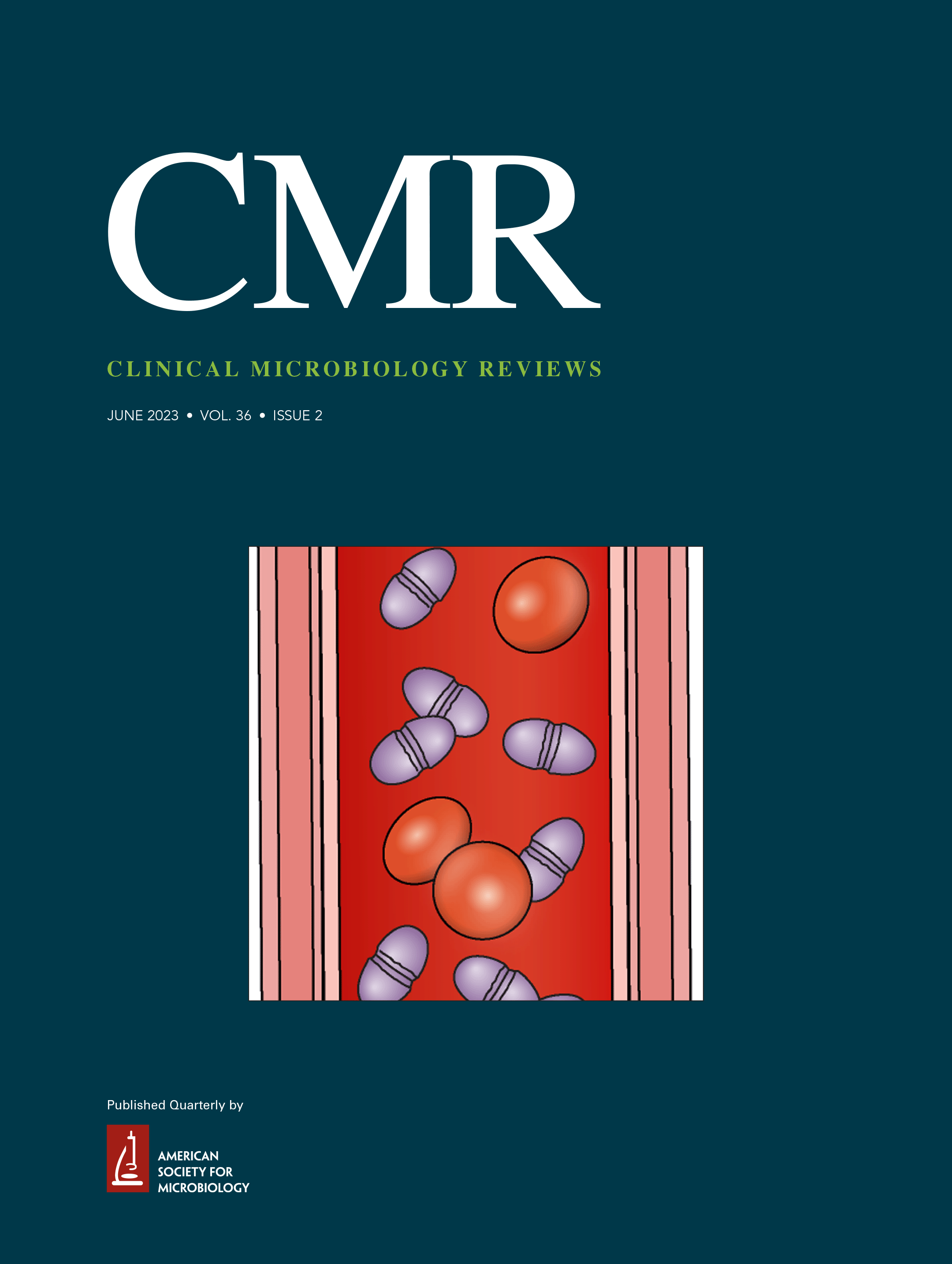 Congenital Syphilis: a Review of Global Epidemiology