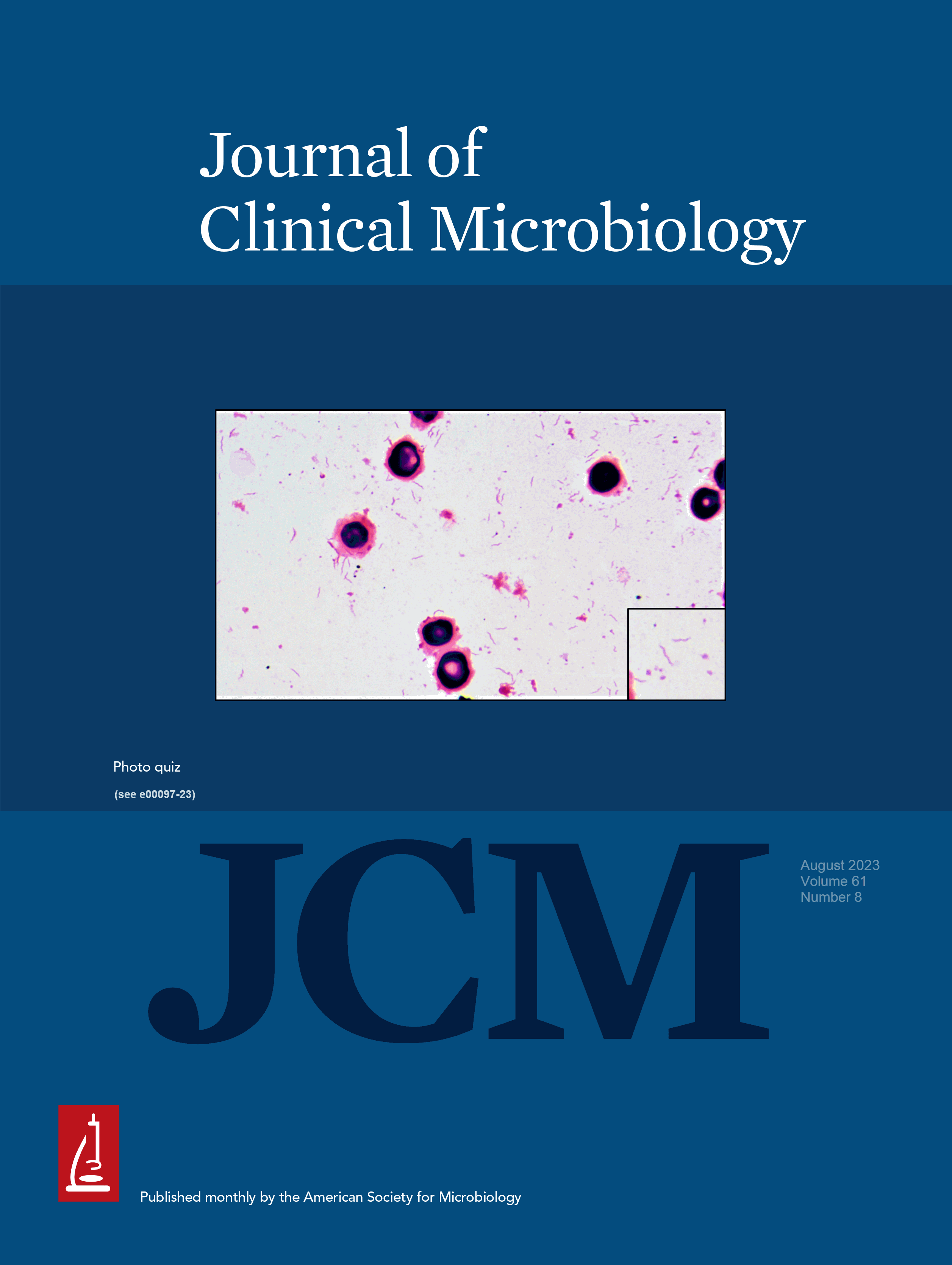 Less Is More: When to Repeat Antimicrobial Susceptibility Testing