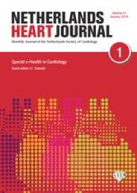 A rare electrocardiographic sign of acute inferior myocardial infarction