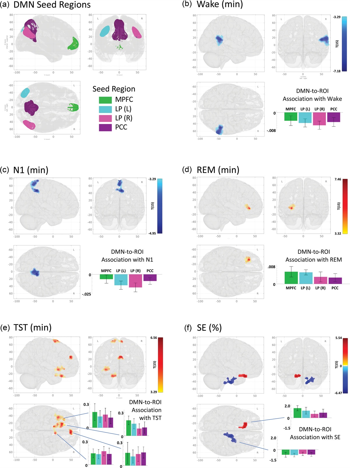 Functional connectivity of the default mode network predicts subsequent polysomnographically measured sleep in people with symptoms of insomnia
