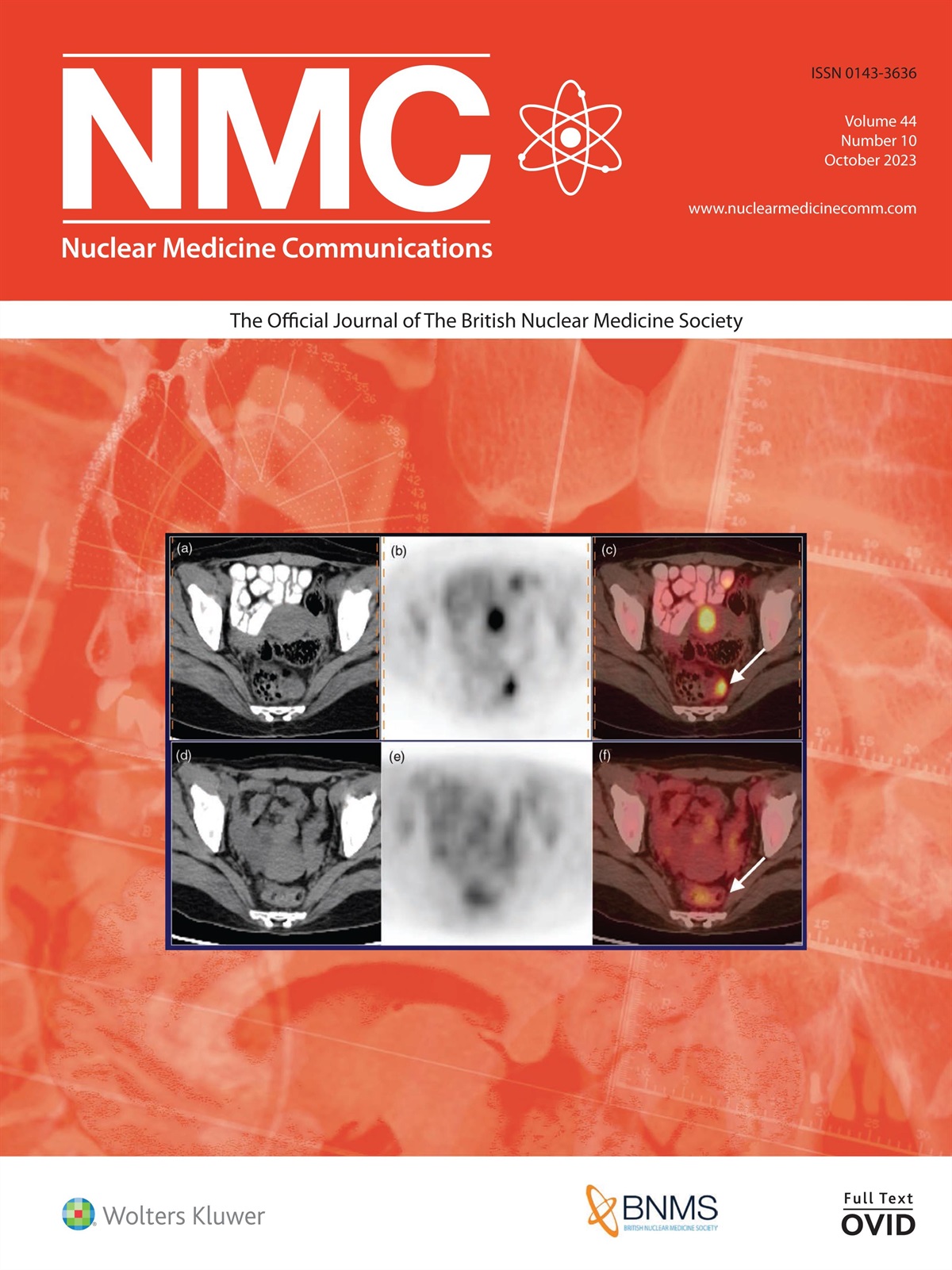 Acronyms in Nuclear Medicine (AINM)