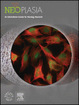 DARPP-32 and t-DARPP in the development of resistance to anti-HER2 agents. Pre-clinical evidence from the STEP study