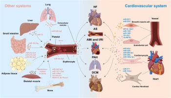 Extracellular Vesicles in Cardiovascular Diseases: From Pathophysiology to Diagnosis and Therapy