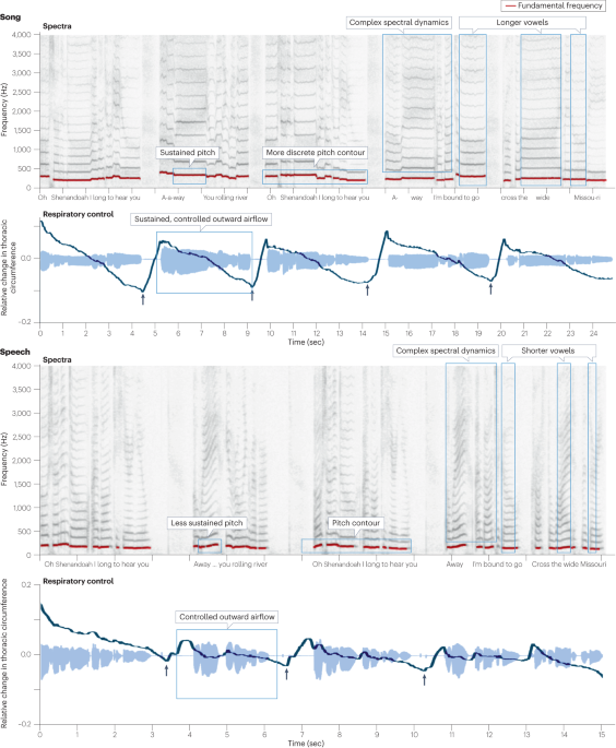 Is song processing distinct and special in the auditory cortex?