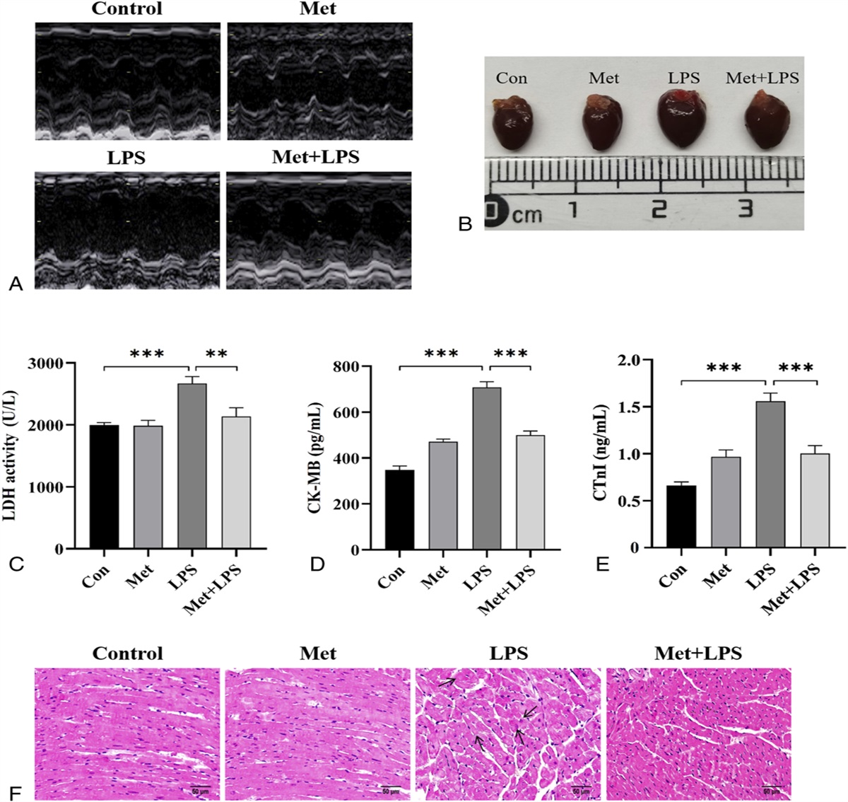 Metformin Alleviates Sepsis-Associated Myocardial Injury by Enhancing AMP-Activated Protein Kinase/Mammalian Target of Rapamycin Signaling Pathway–Mediated Autophagy