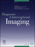 Imaging features of intrauterine incarceration of epiploic appendage