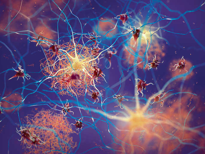 ApoE attracts microglia to amyloid-β plaques