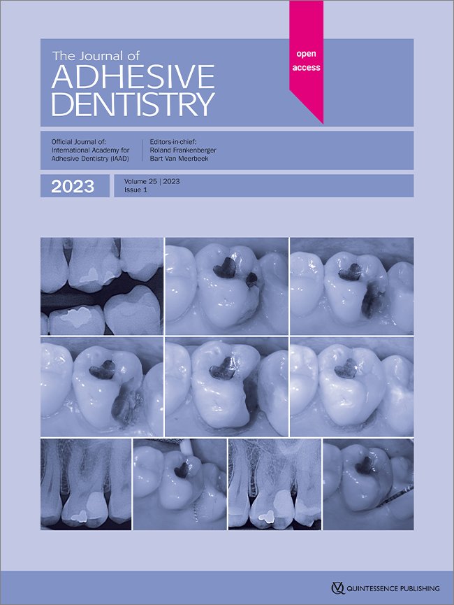 Randomized Clinical Split-Mouth Study on Partial Ceramic Crowns Luted with a Self-adhesive Resin Cement with or without Selective Enamel Etching: Long-Term Results after 15 Years
