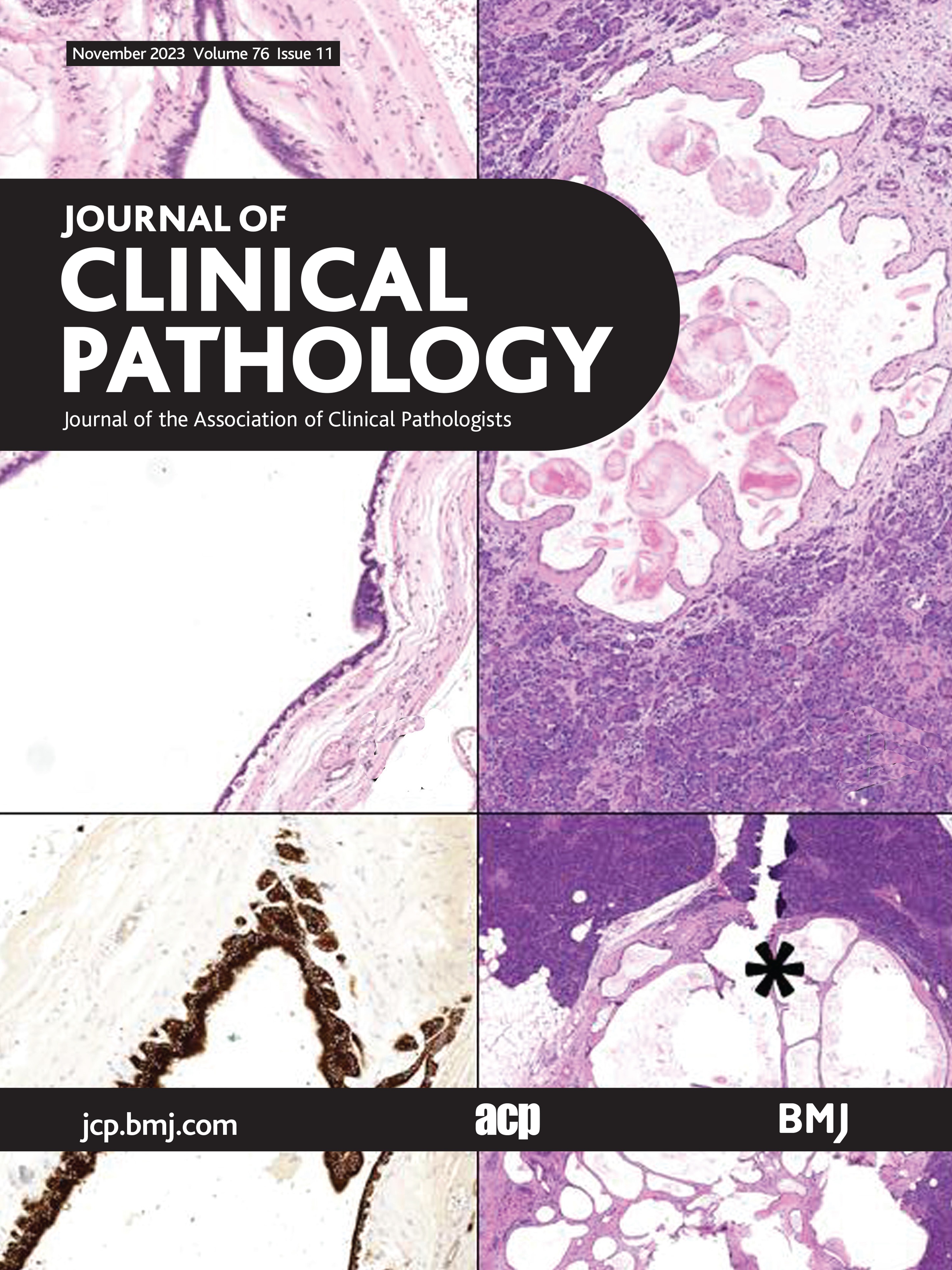 Comparison of two pathological processing methods for large endoscopic submucosal dissection (ESD) specimens