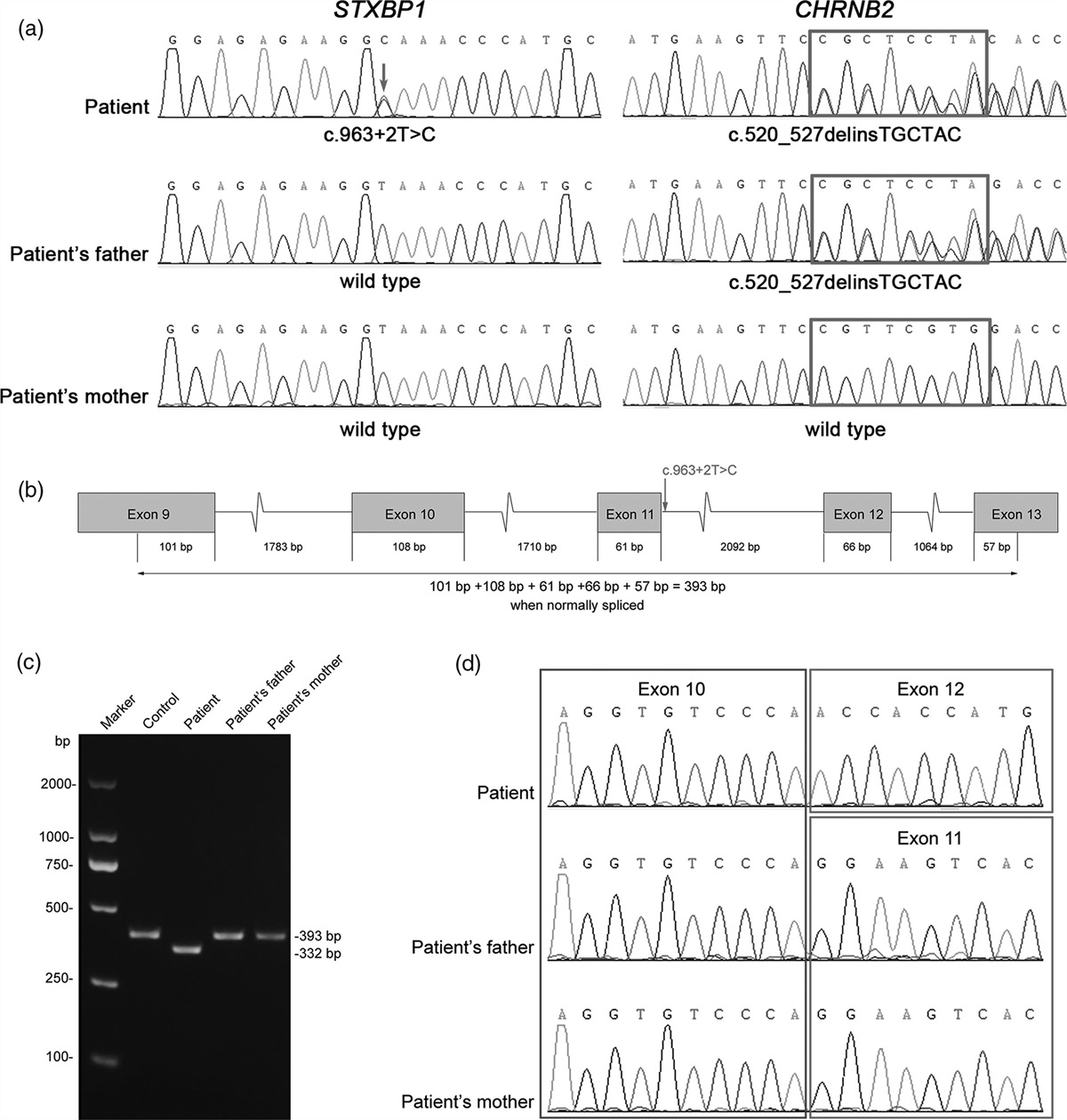 Two novel variants of the STXBP1 and CHRNB2 genes identified in a Chinese boy with refractory seizures and developmental delay