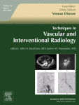 Endovascular treatment of venous outflow and portal venous complications after liver transplantation