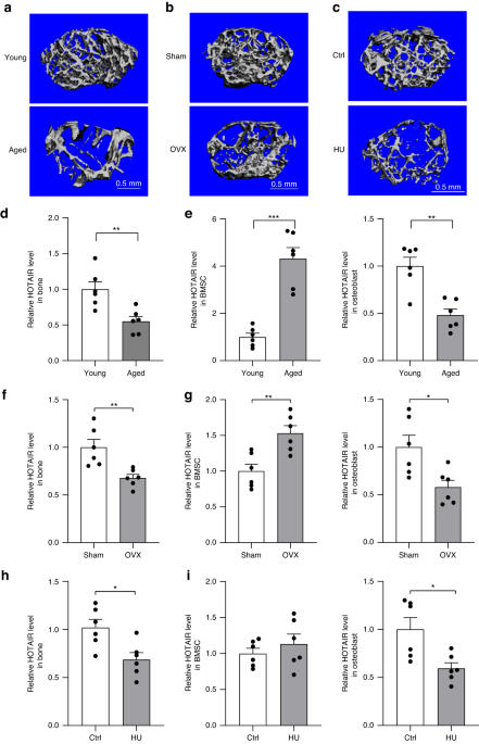 HuR-mediated nucleocytoplasmic translocation of HOTAIR relieves its inhibition of osteogenic differentiation and promotes bone formation