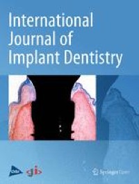 A systematic review of the accuracy of digital surgical guides for dental implantation