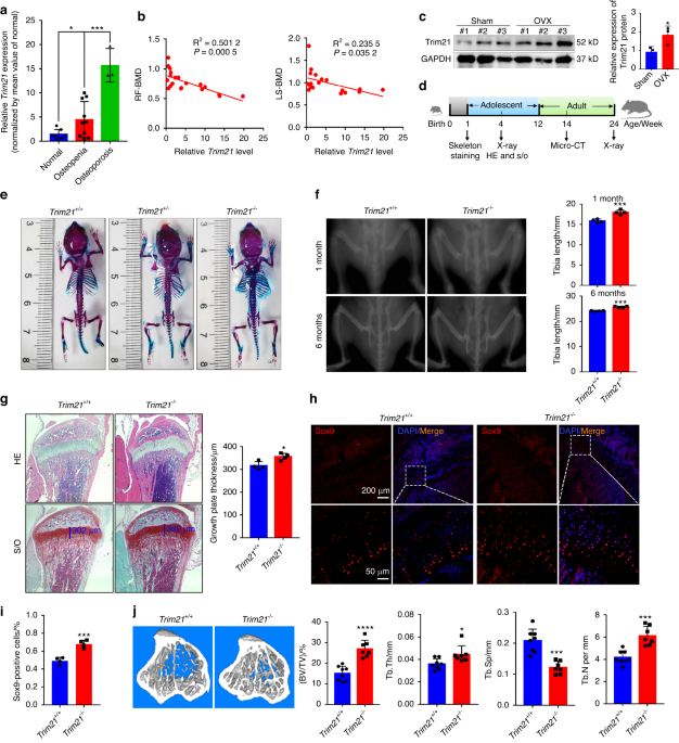 Trim21 depletion alleviates bone loss in osteoporosis via activation of YAP1/β-catenin signaling