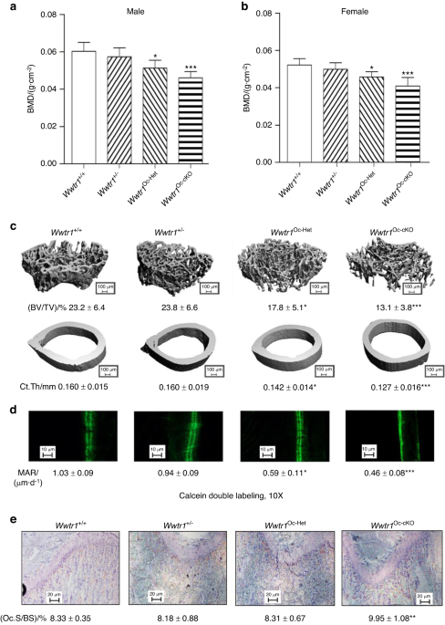 Genetic interactions between polycystin-1 and Wwtr1 in osteoblasts define a novel mechanosensing mechanism regulating bone formation in mice