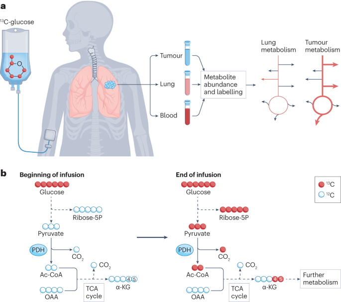 Metabolic pathway analysis using stable isotopes in patients with cancer