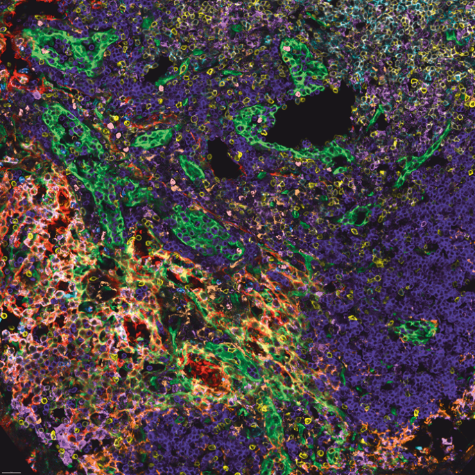 IBEX: a user-friendly and open-source solution for high-plex immunostaining