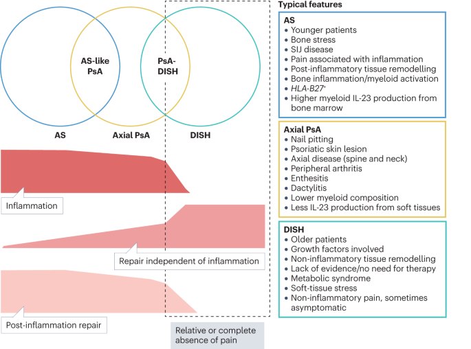 Predominant ligament-centric soft-tissue involvement differentiates axial psoriatic arthritis from ankylosing spondylitis