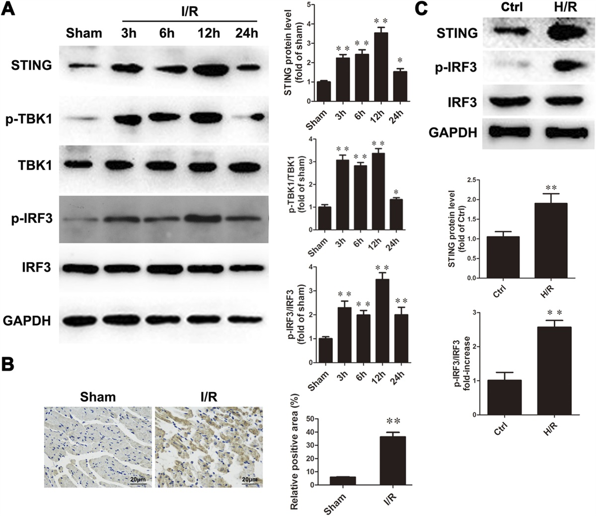 The STING-IRF3 Signaling Pathway, Mediated by Endoplasmic Reticulum Stress, Contributes to Impaired Myocardial Autophagic Flux After Ischemia/Reperfusion