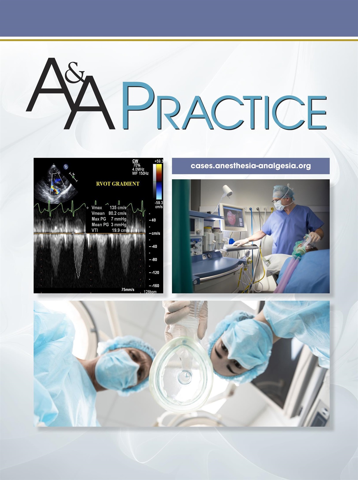 Congenital Myasthenic Syndrome With Malignant Hyperthermia Susceptibility in a Child Undergoing Adenotonsillectomy for Obstructive Sleep Apnea: A Case Report