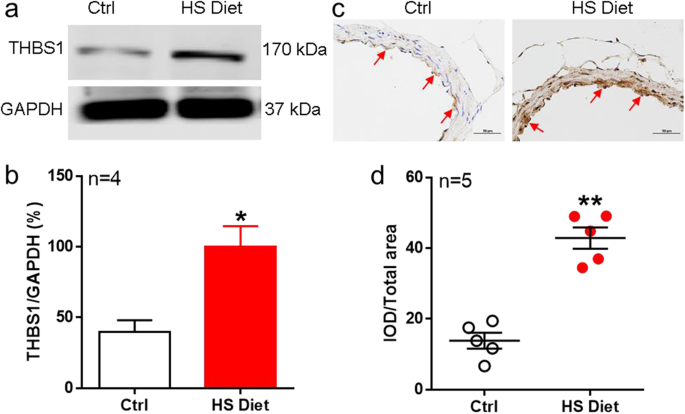 Role of thrombospondin-1 in high-salt–induced mesenteric artery endothelial impairment in rats