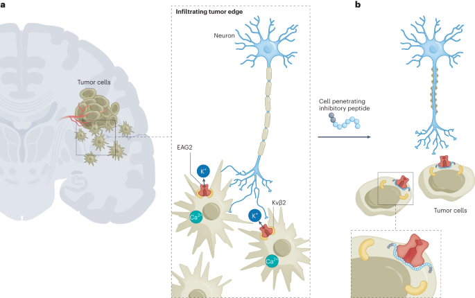 Targeting network circuitry in glioma