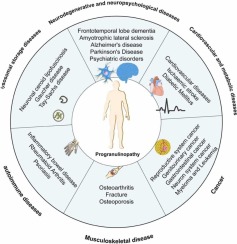 Progranulinopathy: A Diverse Realm of Disorders Linked to Progranulin Imbalances