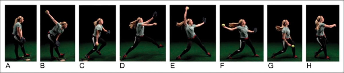 Common Injuries in Female Competitive Softball Players