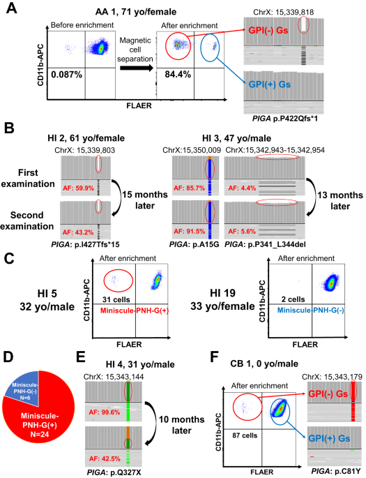 Minor GPI(-) granulocyte populations in aplastic anemia and healthy individuals derived from a few PIGA-mutated hematopoietic stem progenitor cells