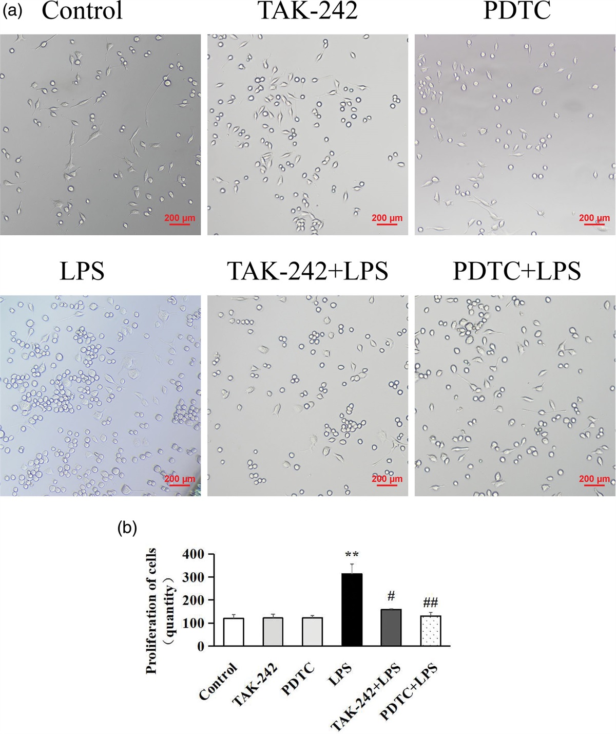 Inhibition of the TLR4/NF-κB pathway promotes the polarization of LPS-induced BV2 microglia toward the M2 phenotype
