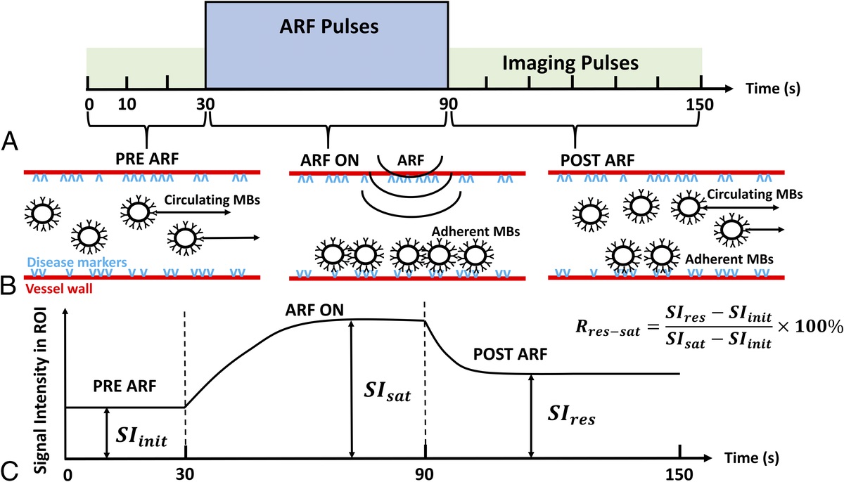 In Vivo Validation of Modulated Acoustic Radiation Force–Based Imaging in Murine Model of Abdominal Aortic Aneurysm Using VEGFR-2–Targeted Microbubbles