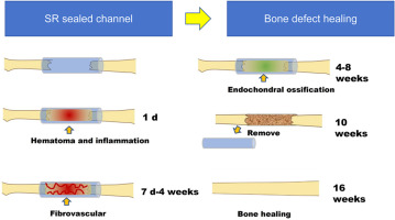 Silicone rubber sealed channel induced self-healing of large bone defects: Where is the limit of self-healing of bone?
