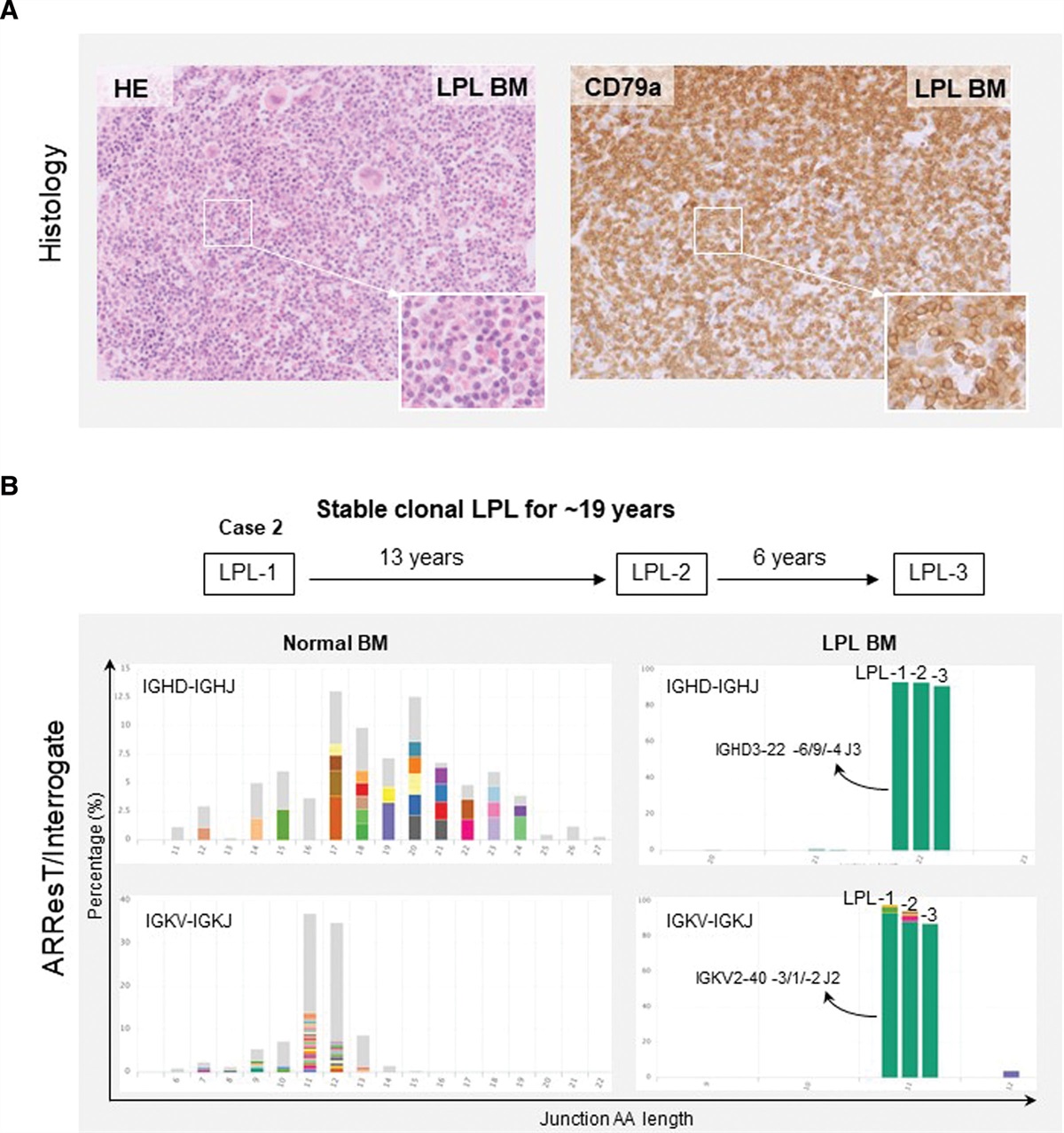 Clonal Relationship and Mutation Analysis in Lymphoplasmacytic Lymphoma/Waldenström Macroglobulinemia Associated With Diffuse Large B-cell Lymphoma