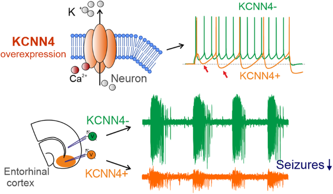Overexpression of KCNN4 channels in principal neurons produces an anti-seizure effect without reducing their coding ability