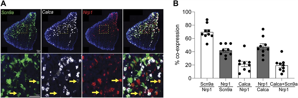 Neuropilin-1 is essential for vascular endothelial growth factor A–mediated increase of sensory neuron activity and development of pain-like behaviors