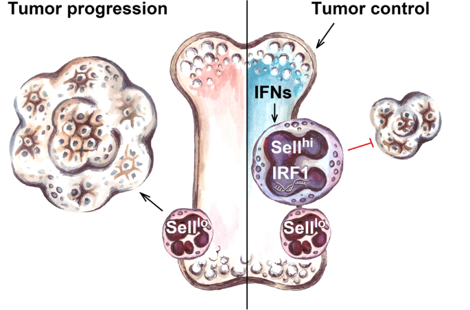 Sellhi neutrophils: a key to triumph in cancer therapy
