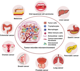 The emerging tumor microbe microenvironment: From delineation to multidisciplinary approach-based interventions