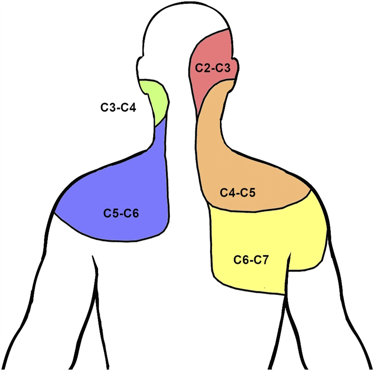 Clinical Diagnosis of Common Overlapping Shoulder and Cervical Spine Disorders: A Review of Current Evidence
