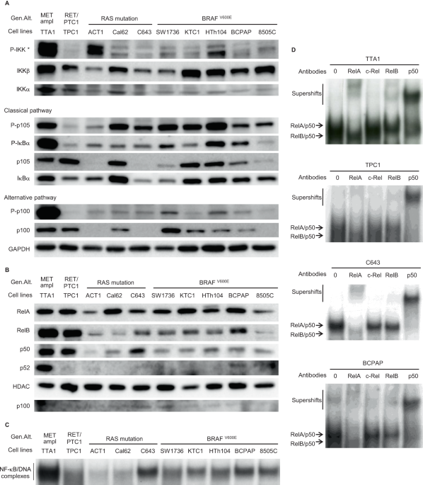 NF-κB signaling activation and roles in thyroid cancers: implication of MAP3K14/NIK