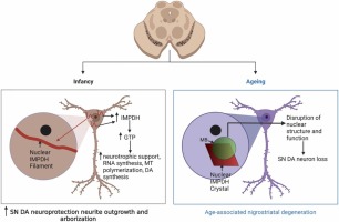 Inosine monophosphate dehydrogenase intranuclear inclusions are markers of aging and neuronal stress in the human substantia nigra