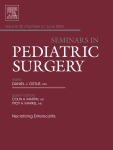Radical Nephroureterectomy for Pediatric Unilateral Renal Tumor
